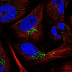 Immunofluorescent staining of human cell line U-251 MG shows localization to vesicles.