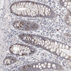 Anti-CCDC190 Antibody