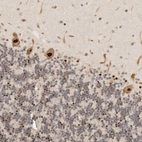 Anti-GPBP1L1 Antibody