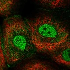Immunofluorescent staining of human cell line A-431 shows localization to nucleoplasm, plasma membrane & cytosol.