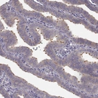 Immunohistochemical staining of human fallopian tube shows moderate to strong positivity in cilia in glandular cells.