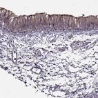 Immunohistochemical staining of human bronchus shows moderate to strong positivity in cilia in respiratory epithelial cells.