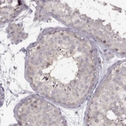 Immunohistochemical staining of human testis shows weak to moderate cytoplasmic positivity in spermatids.