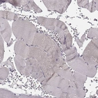 Immunohistochemical staining of human skeletal muscle shows no positivity in myocytes as expected.