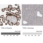 Anti-TFRC Antibody