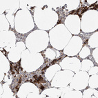 Immunohistochemical staining of human bone marrow shows strong cytoplasmic positivity in hematopoietic cells.