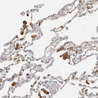 Immunohistochemical staining of human lung shows strong cytoplasmic positivity in macrophages.