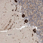 Immunohistochemical staining of human cerebellum shows strong cytoplasmic positivity in Purkinje cells.