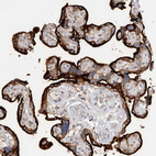 Immunohistochemical staining of human placenta shows strong membranous positivity in trophoblastic cells.
