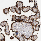 Anti-TFRC Antibody