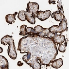 Immunohistochemical staining of human placenta shows strong membranous positivity in trophoblastic cells.