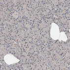 Anti-TFRC Antibody