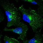 Immunofluorescent staining of human cell line U-251 MG shows localization to endosomes & lysosomes.