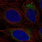 Immunofluorescent staining of human cell line U-2 OS shows localization to endoplasmic reticulum & vesicles.