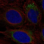Immunofluorescent staining of human cell line U-2 OS shows localization to endoplasmic reticulum & vesicles.