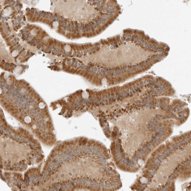 Anti-IQCC Antibody
