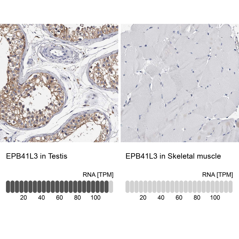 Anti-EPB41L3 Antibody