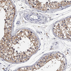 Immunohistochemical staining of human testis shows moderate cytoplasmic and membranous positivity in cells in seminiferous ducts.