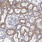 Immunohistochemical staining of human kidney shows moderate to strong membranous positivity in cells in tubules.