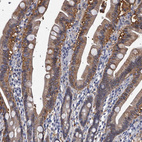 Immunohistochemical staining of human gastrointestinal shows moderate to strong cytoplasmic and membranous positivity in glandular cells.