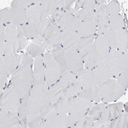 Immunohistochemical staining of human skeletal muscle shows no positivity in myocytes as expected.