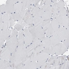 Immunohistochemical staining of human skeletal muscle shows no positivity in myocytes as expected.