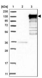 Lane 1: Marker [kDa] 230, 130, 95, 72, 56, 36, 28, 17, 11_br/_Lane 2: Human cell line RT-4_br/_Lane 3: Human cell line U-251MG sp