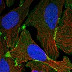 Immunofluorescent staining of human cell line U-2 OS shows localization to plasma membrane.