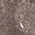 Anti-RBM34 Antibody