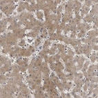 Anti-GCH1 Antibody