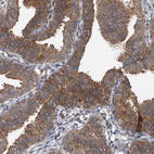 Anti-GEMIN8 Antibody