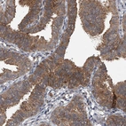 Anti-GEMIN8 Antibody