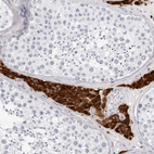 Immunohistochemical staining of human testis shows strong cytoplasmic positivity in Leydig cells.