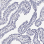 Immunohistochemical staining of human fallopian tube shows no positivity in glandular cells as expected.
