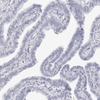 Immunohistochemical staining of human fallopian tube shows no positivity in glandular cells as expected.