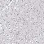 Immunohistochemical staining of human liver shows no positivity in hepatocytes as expected.