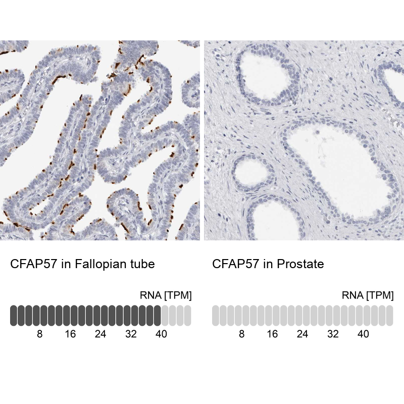 Anti-CFAP57 Antibody