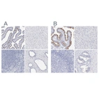 Immunohistochemical staining of human fallopian tube, liver, lymph node and prostate using Anti-CFAP57 antibody HPA028623 (A) shows similar protein distribution across tissues to independent antibody HPA002736 (B).