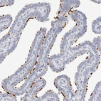 Immunohistochemical staining of human Fallopian tube shows strong positivity in cilia in glandular cells.