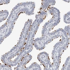 Immunohistochemical staining of human Fallopian tube shows strong positivity in cilia in glandular cells.