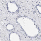 Immunohistochemical staining of human prostate shows no positivity in glandular cells as expected.