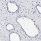 Immunohistochemical staining of human prostate shows no positivity in glandular cells as expected.