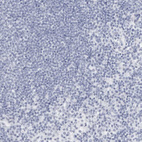 Immunohistochemical staining of human lymph node shows no positivity in lymphoid cells as expected.