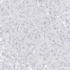 Immunohistochemical staining of human liver shows no positivity in hepatocytes as expected.