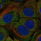 Immunofluorescent staining of human cell line HaCaT shows localization to cytosol.