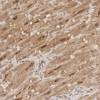 Anti-TARS2 Antibody