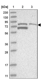 Lane 1: Marker [kDa] 230, 130, 95, 72, 56, 36, 28, 17, 11_br/_Lane 2: Human cell line RT-4_br/_Lane 3: Human cell line U-251MG sp