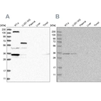Western blot analysis using Anti-PPP1R42 antibody HPA028628 (A) shows similar pattern to independent antibody HPA027983 (B).