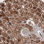 Anti-RAB11FIP3 Antibody