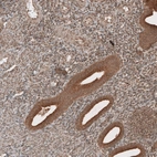 Immunohistochemical staining of human endometrium shows moderate to strong cytoplasmic positivity in glandular cells.